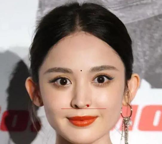 鼻翼缩小的女明星